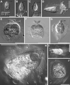 Differential interference contrast light micrographs of Spirotrichonymphea symbionts from Heterotermes aureus.